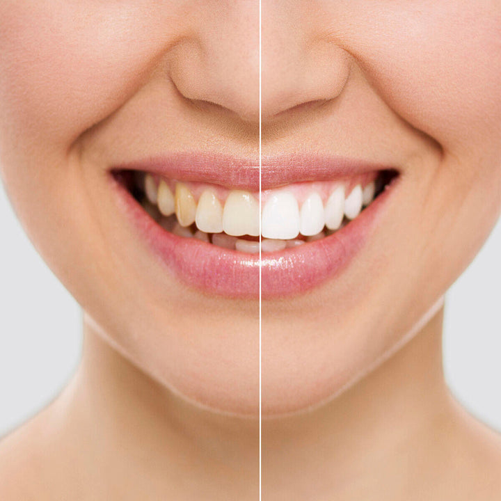 Tiras Blanqueadoras Dentales Wripes